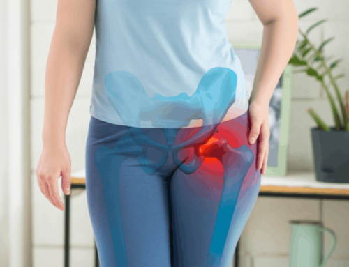 EJERCICIOS PROHIBIDOS PARA EL PINZAZMIENTO DE CADERA